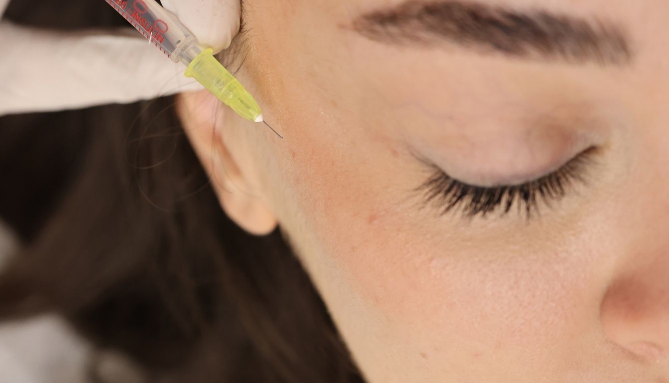 Mesotherapy Applications – Facial Mesotherapy