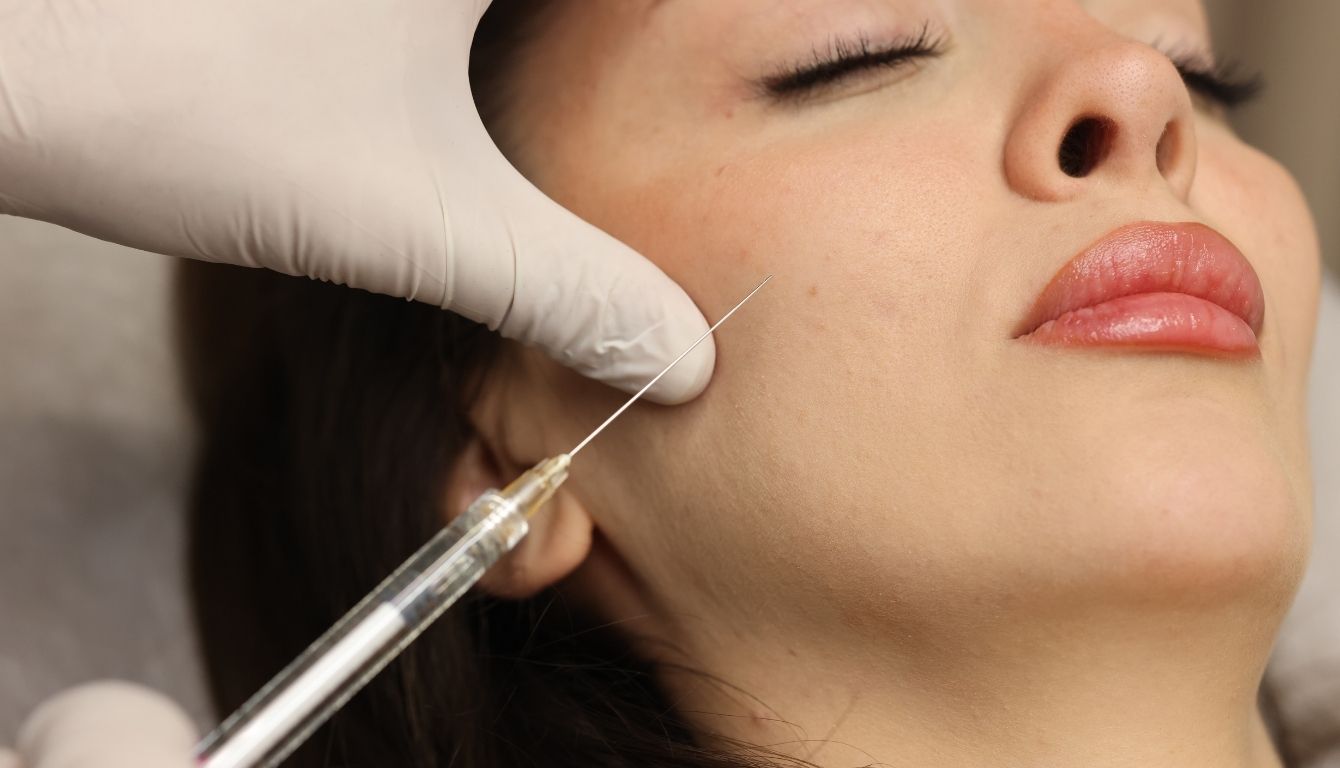 Dermal Filler Applications – Malar Augmentation