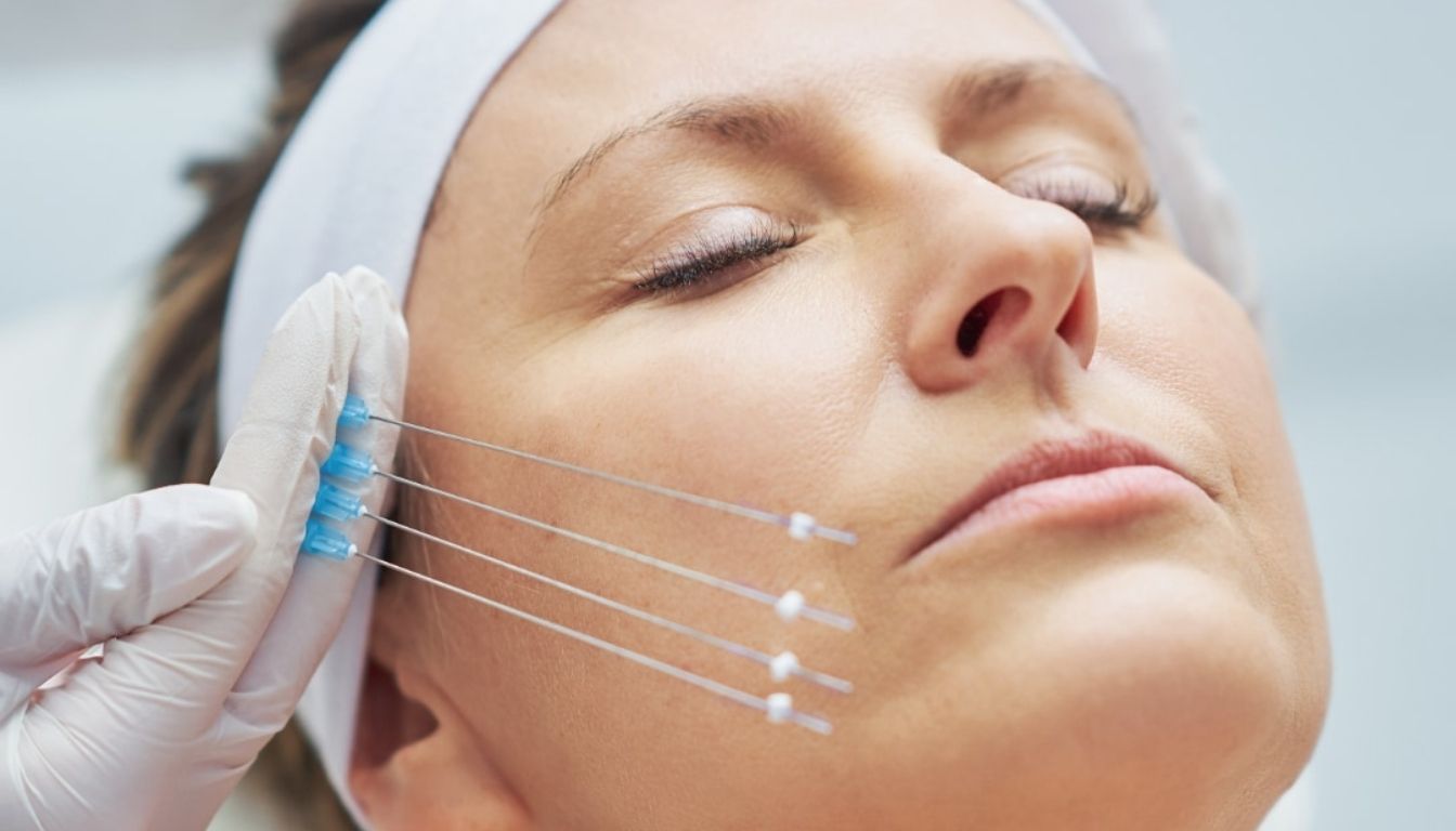 Thread Lifting Applications – Face Lifting